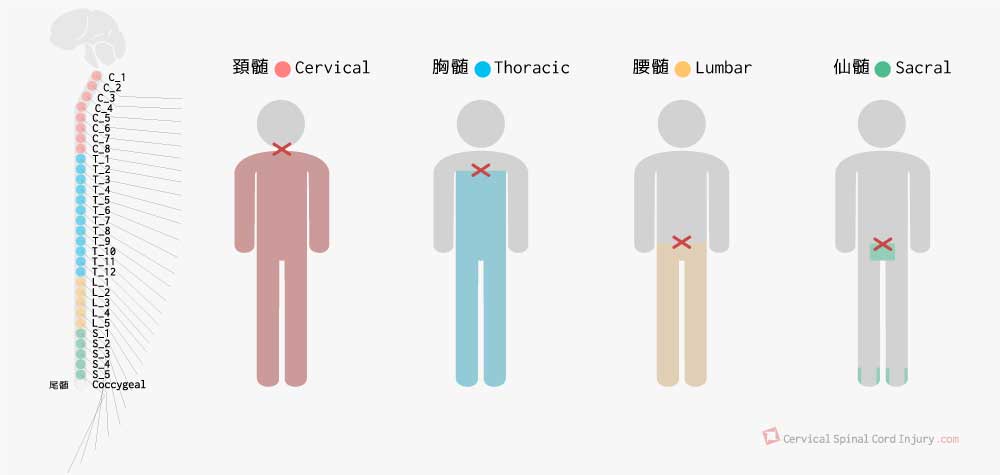 脊髄髄節と損傷レベル